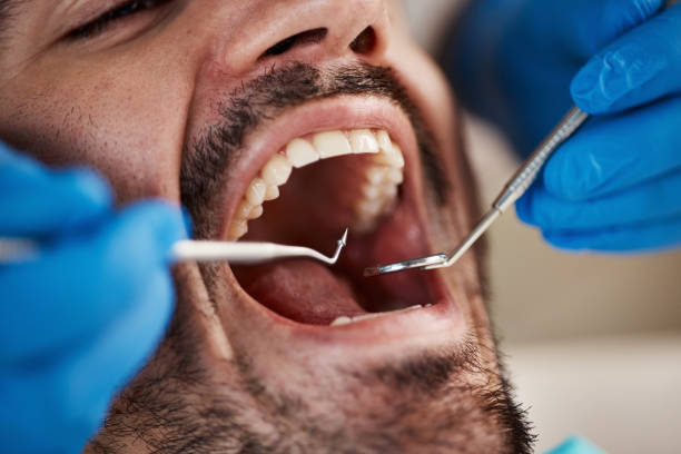 Dental Bonding in Rock Island, IL